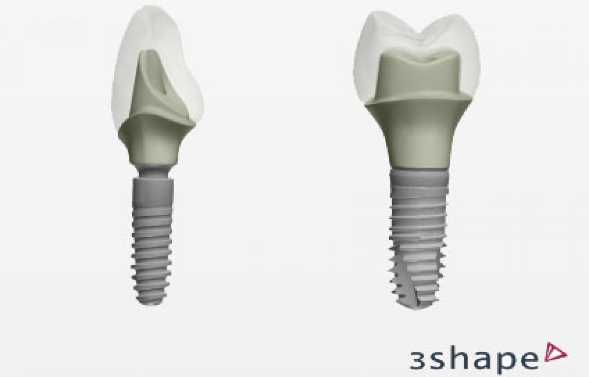  3Shape’s Dental System™ offers CAD Design of DENTSPLY Friadent 
