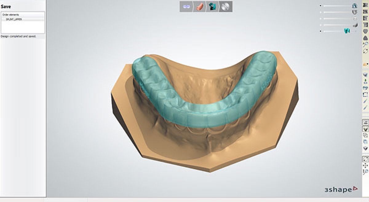 3Shape’s new Splint Designer™ CAD software 