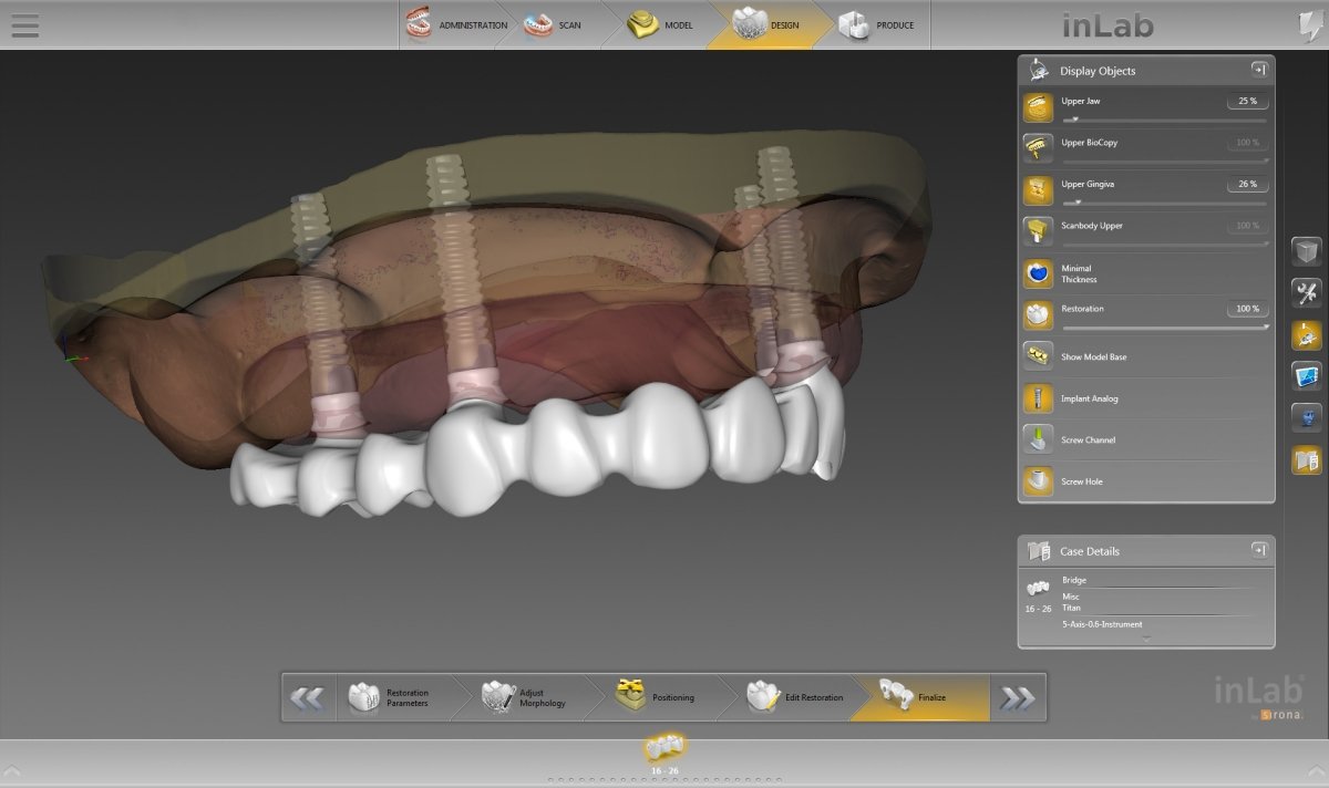 Dentsply Sirona presents inLab CAD Software 16.0